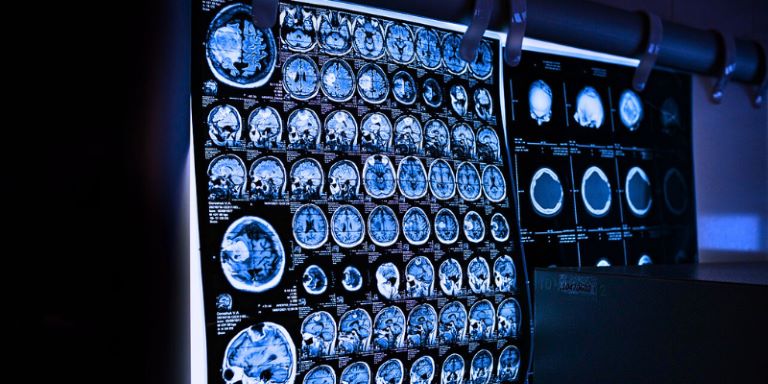 Dodati leta življenju ali življenje letom?